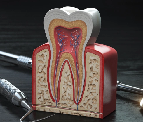 root canals in huntington beach