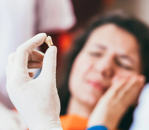 tooth extractions in huntington beach